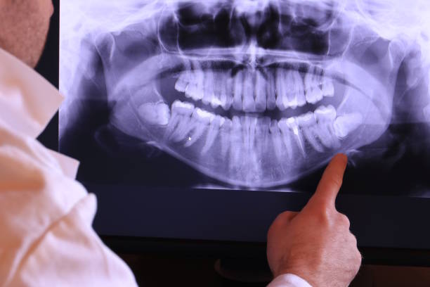 Best Emergency Denture Repair in Millersburg, OR