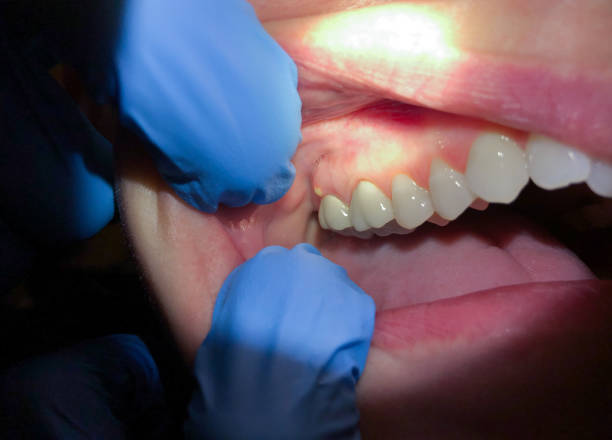 Best Emergency Treatment for Jaw Pain or Injury in Millersburg, OR