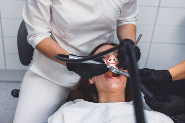 Best Knocked-Out Tooth (Avulsed Tooth) Treatment in Millersburg, OR